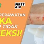 Panduan Lengkap Merawat Luka Terbuka Agar Tidak Infeksi