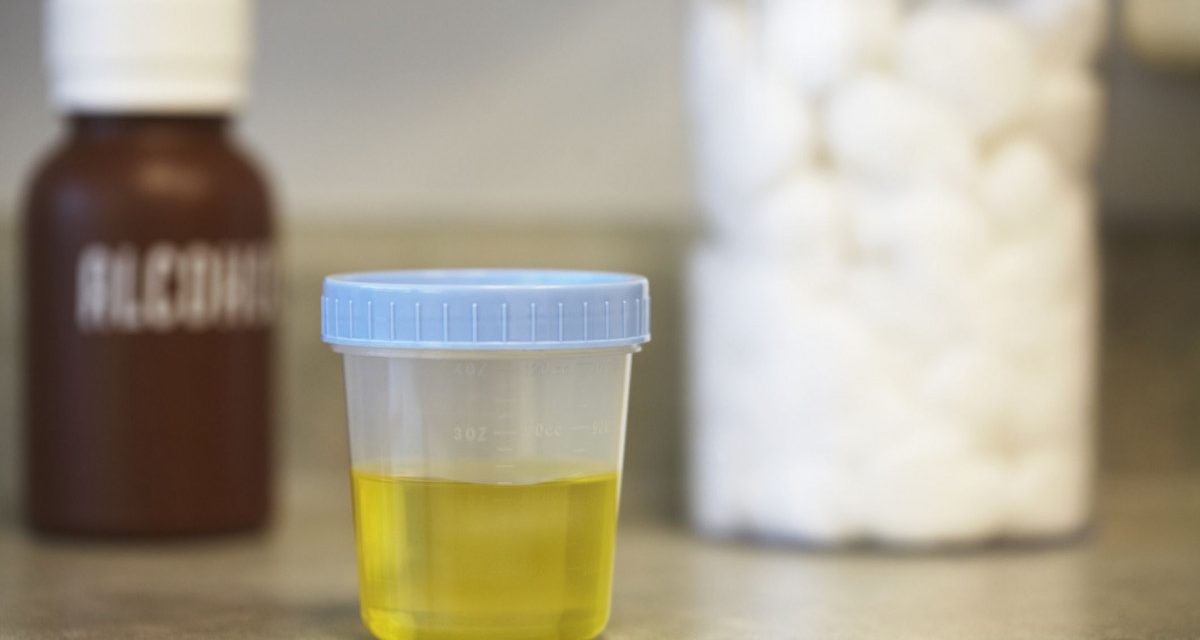 Ini 5 Penyebab Yang Harus Diketahui Jika Urine Terasa Panas