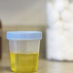 Ini 5 Penyebab Yang Harus Diketahui Jika Urine Terasa Panas