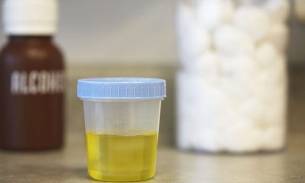 Ini 5 Penyebab Yang Harus Diketahui Jika Urine Terasa Panas