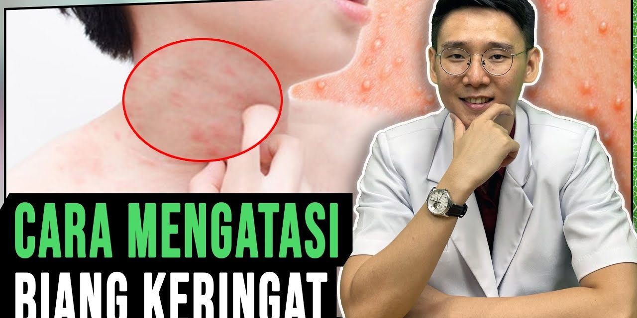 Faktor Penyebab Biang Keringat Dan Penanganan Yang Tepat