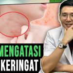 Faktor Penyebab Biang Keringat Dan Penanganan Yang Tepat