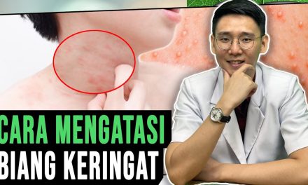 Faktor Penyebab Biang Keringat Dan Penanganan Yang Tepat