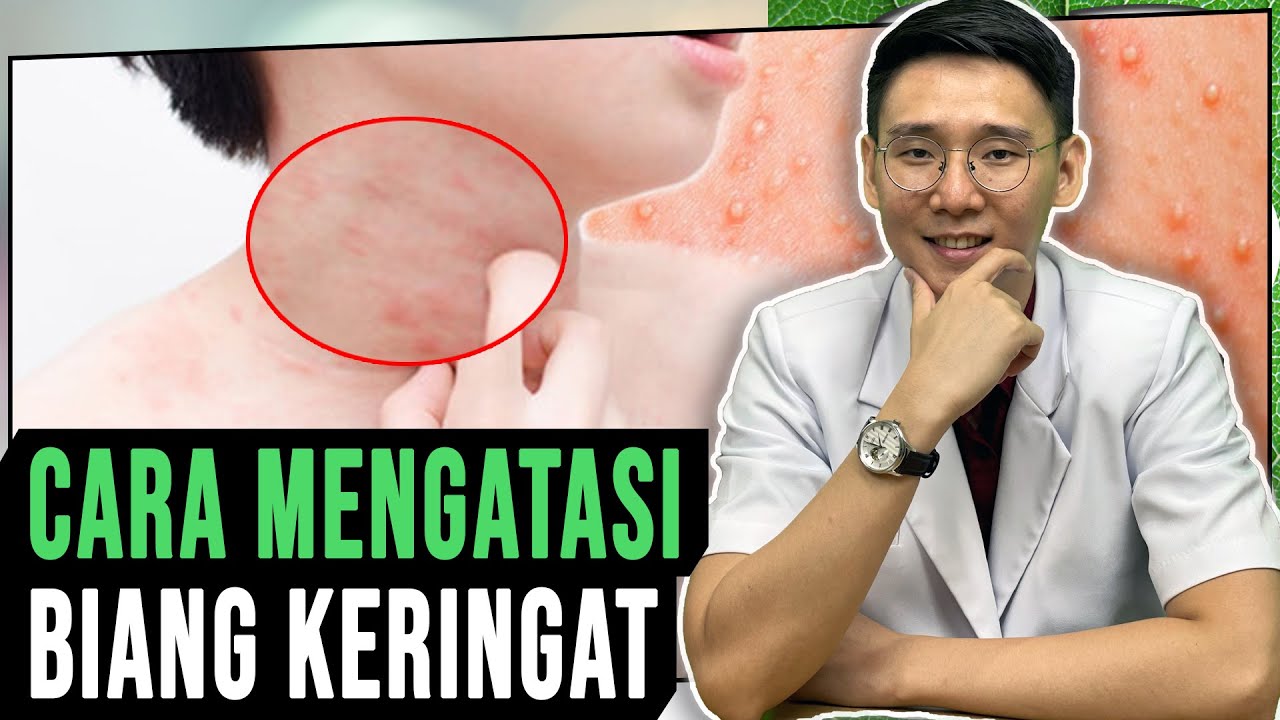 Faktor Penyebab Biang Keringat